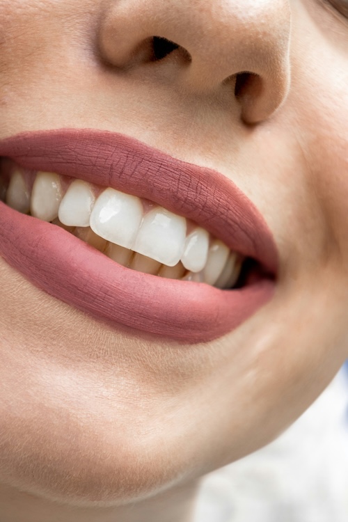 Smiling female teeth whitening patient in Chattanooga, TN